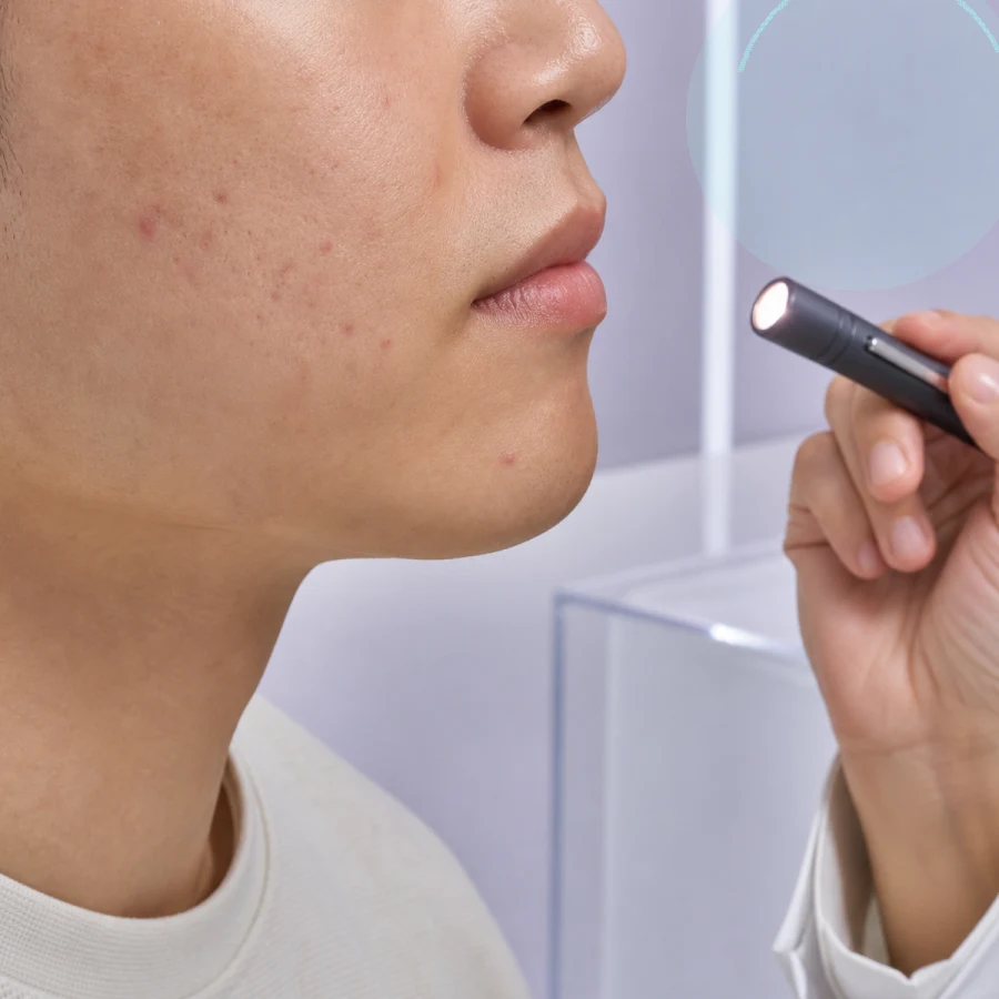 울산피부과 보호구 마찰과 땀을 구분하는 모낭 기록 | 울산피부과 정보 대표 이미지
